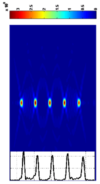 Laser Multifocal Lens